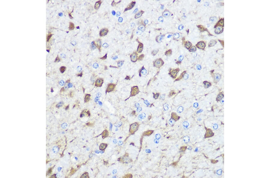 Immunohistochemistry - Anti-Parvalbumin Antibody (A88215) - Antibodies.com