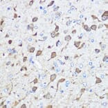 Immunohistochemistry - Anti-Parvalbumin Antibody (A88215) - Antibodies.com