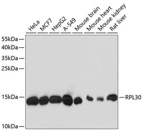 Western Blot - Anti-RPL30 Antibody (A88216) - Antibodies.com