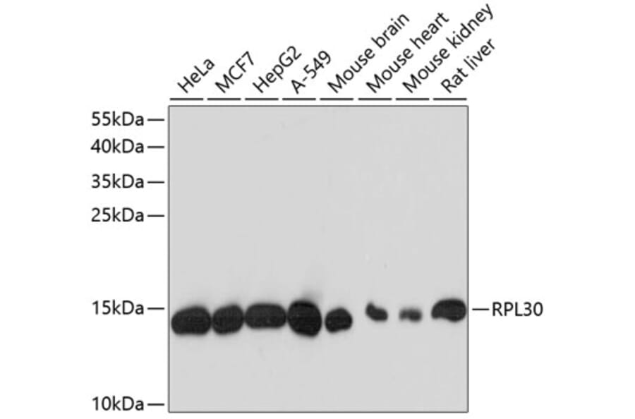 Western Blot - Anti-RPL30 Antibody (A88216) - Antibodies.com