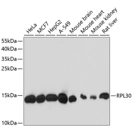 Western Blot - Anti-RPL30 Antibody (A88216) - Antibodies.com