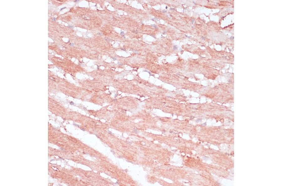 Immunohistochemistry - Anti-RPL30 Antibody (A88216) - Antibodies.com