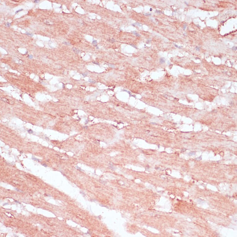 Immunohistochemistry - Anti-RPL30 Antibody (A88216) - Antibodies.com