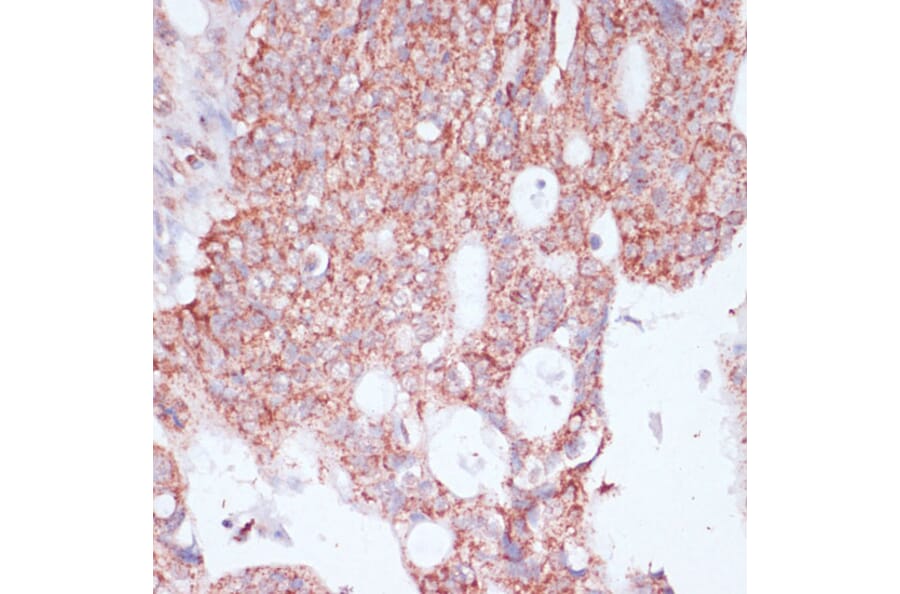 Immunohistochemistry - Anti-RPL30 Antibody (A88216) - Antibodies.com