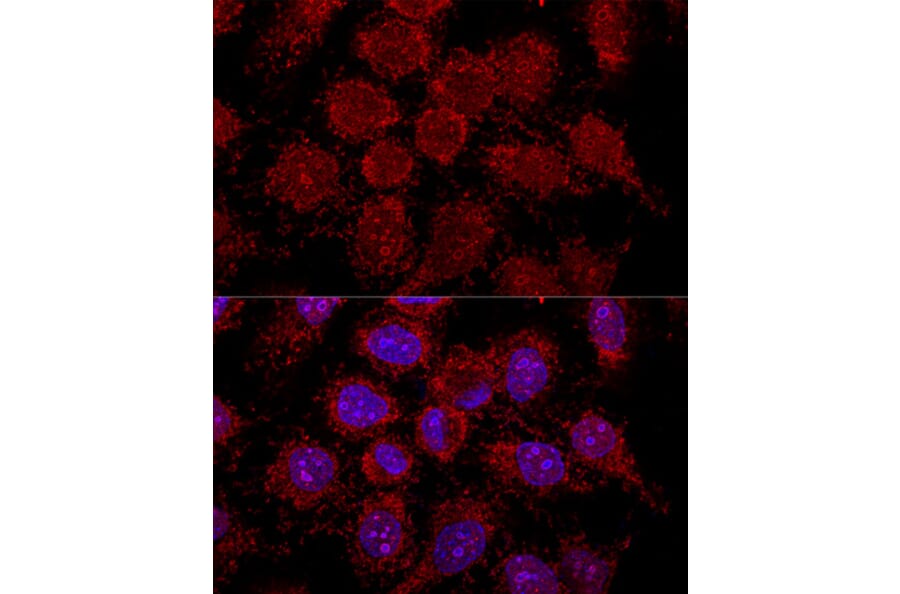Immunofluorescence - Anti-RPL30 Antibody (A88216) - Antibodies.com