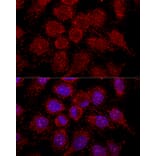 Immunofluorescence - Anti-RPL30 Antibody (A88216) - Antibodies.com