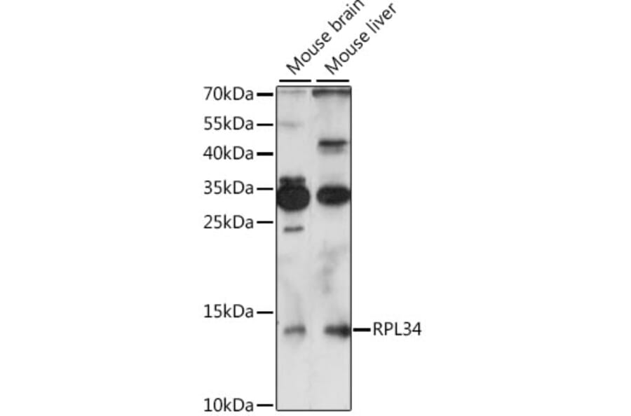 Western Blot - Anti-RPL34 Antibody (A88217) - Antibodies.com