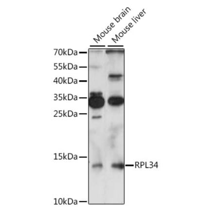 Western Blot - Anti-RPL34 Antibody (A88217) - Antibodies.com