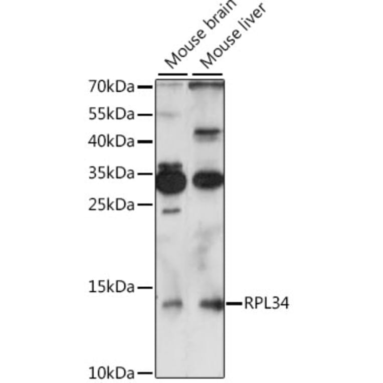 Western Blot - Anti-RPL34 Antibody (A88217) - Antibodies.com