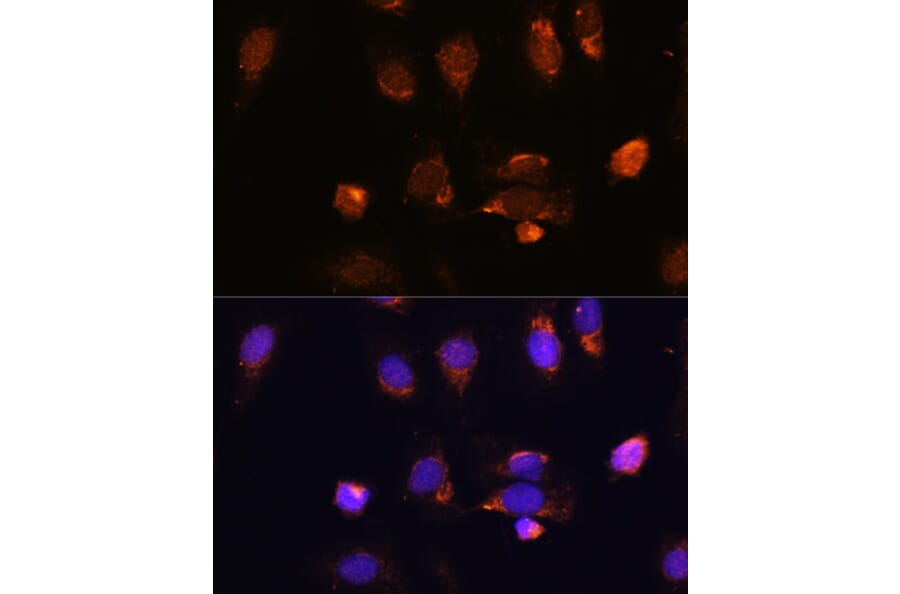 Immunofluorescence - Anti-RPL34 Antibody (A88217) - Antibodies.com