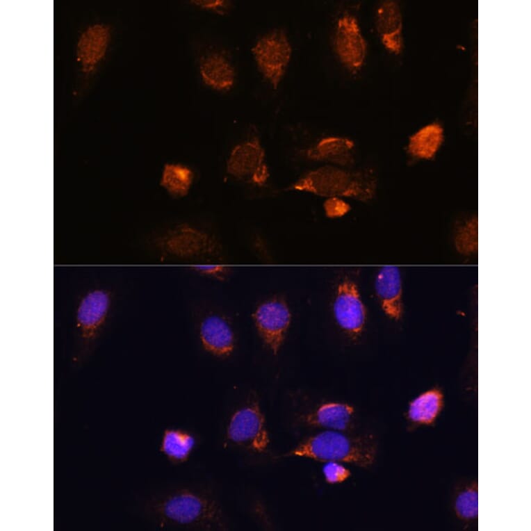 Immunofluorescence - Anti-RPL34 Antibody (A88217) - Antibodies.com