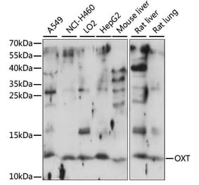 Western Blot - Anti-Oxytocin-neurophysin 1 Antibody (A88219) - Antibodies.com