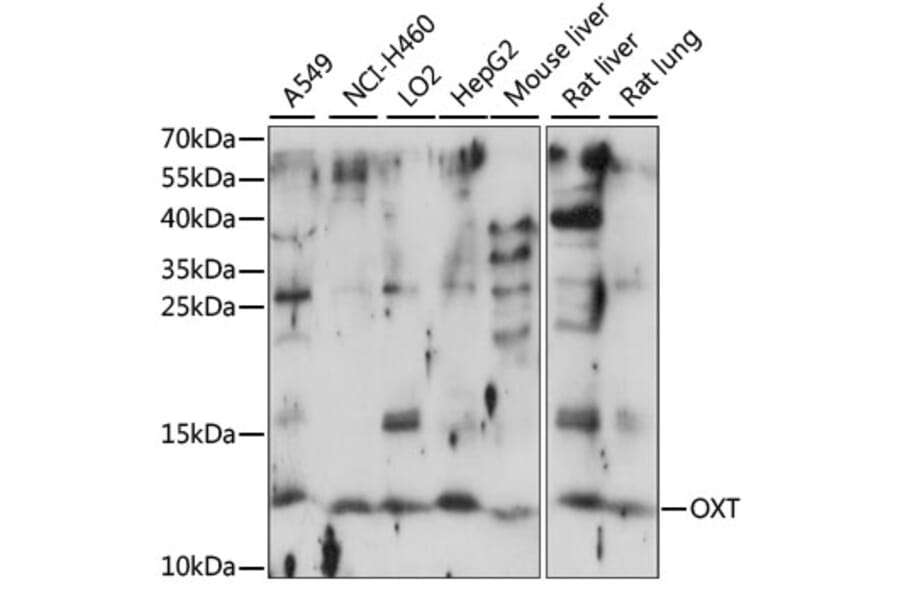 Western Blot - Anti-Oxytocin-neurophysin 1 Antibody (A88219) - Antibodies.com