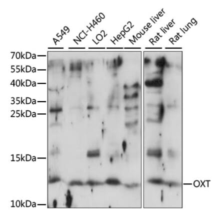 Western Blot - Anti-Oxytocin-neurophysin 1 Antibody (A88219) - Antibodies.com