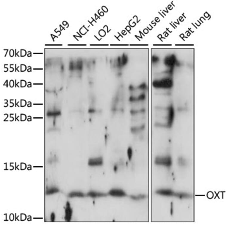 Western Blot - Anti-Oxytocin-neurophysin 1 Antibody (A88219) - Antibodies.com