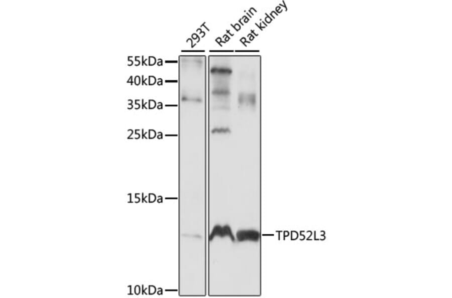 Western Blot - Anti-TPD52L3 Antibody (A88221) - Antibodies.com
