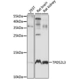Western Blot - Anti-TPD52L3 Antibody (A88221) - Antibodies.com