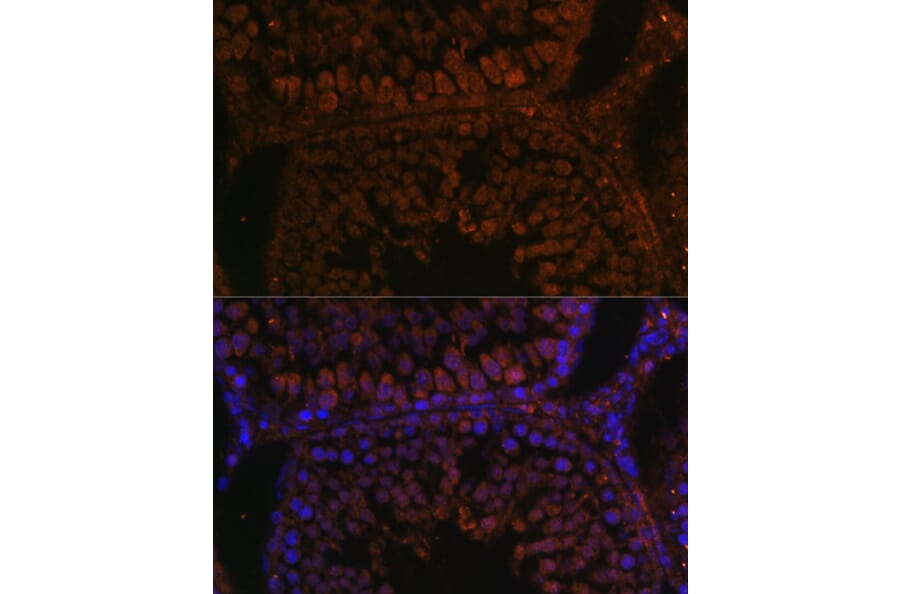 Immunofluorescence - Anti-TPD52L3 Antibody (A88221) - Antibodies.com
