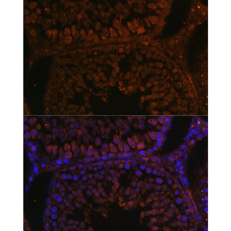 Immunofluorescence - Anti-TPD52L3 Antibody (A88221) - Antibodies.com
