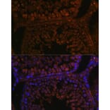 Immunofluorescence - Anti-TPD52L3 Antibody (A88221) - Antibodies.com