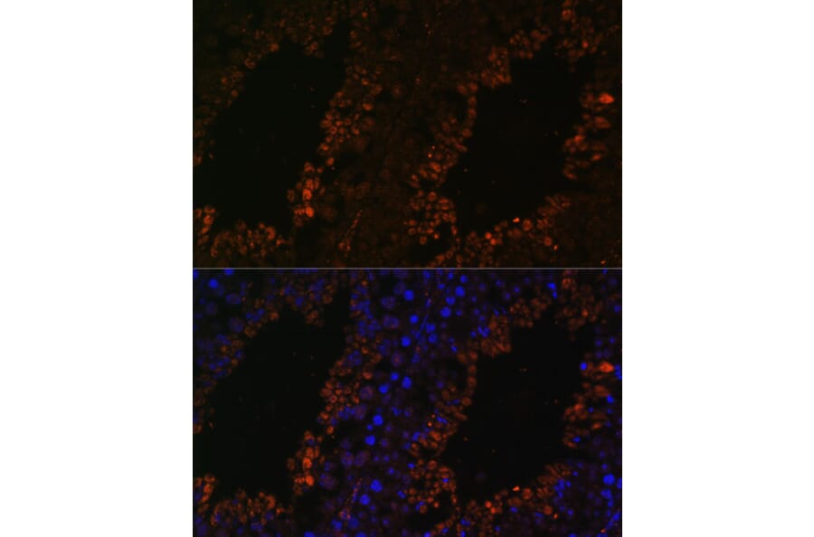 Immunofluorescence - Anti-TPD52L3 Antibody (A88221) - Antibodies.com