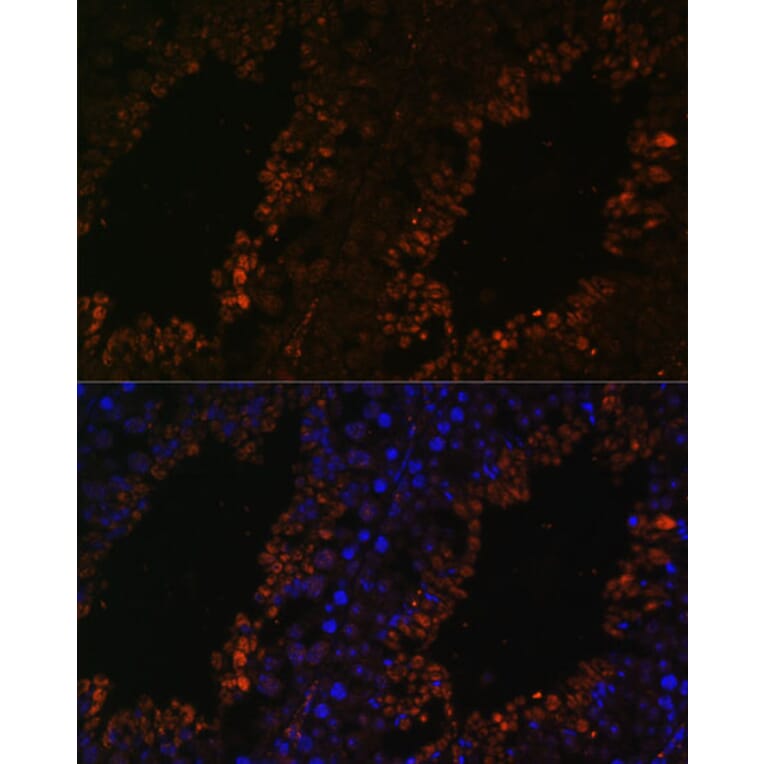 Immunofluorescence - Anti-TPD52L3 Antibody (A88221) - Antibodies.com