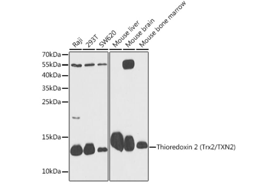 Western Blot - Anti-Thioredoxin 2 Antibody (A88222) - Antibodies.com