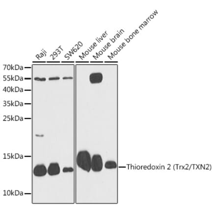 Western Blot - Anti-Thioredoxin 2 Antibody (A88222) - Antibodies.com