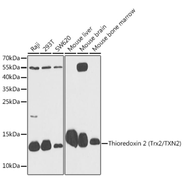 Western Blot - Anti-Thioredoxin 2 Antibody (A88222) - Antibodies.com