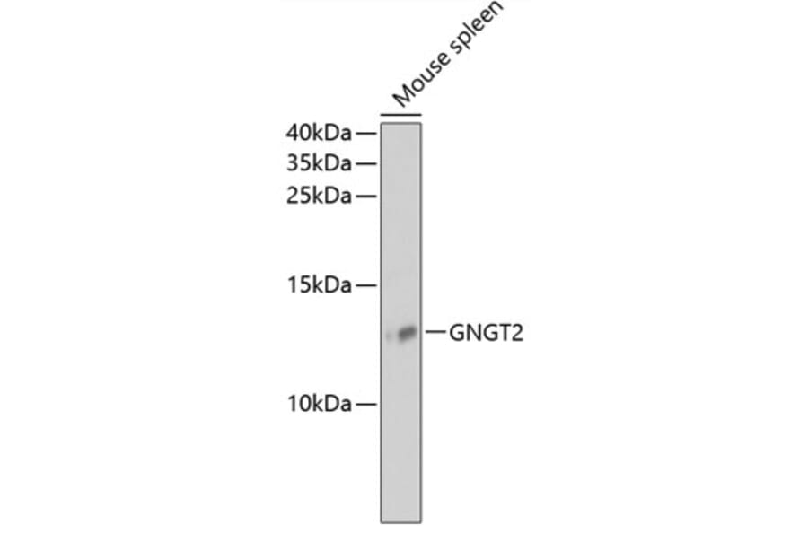 Western Blot - Anti-GNGT2 Antibody (A88223) - Antibodies.com