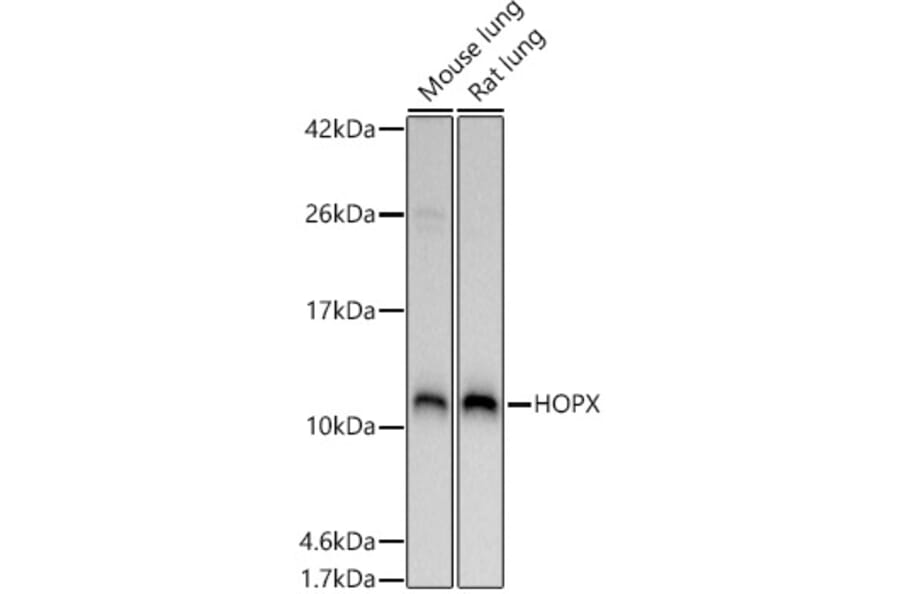 Western Blot - Anti-HOPX/HOD Antibody (A88224) - Antibodies.com
