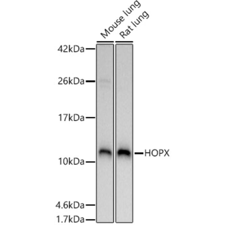 Western Blot - Anti-HOPX/HOD Antibody (A88224) - Antibodies.com