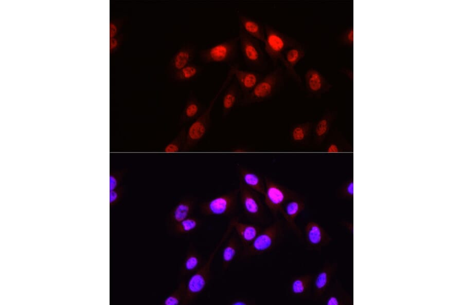 Immunofluorescence - Anti-HOPX/HOD Antibody (A88224) - Antibodies.com
