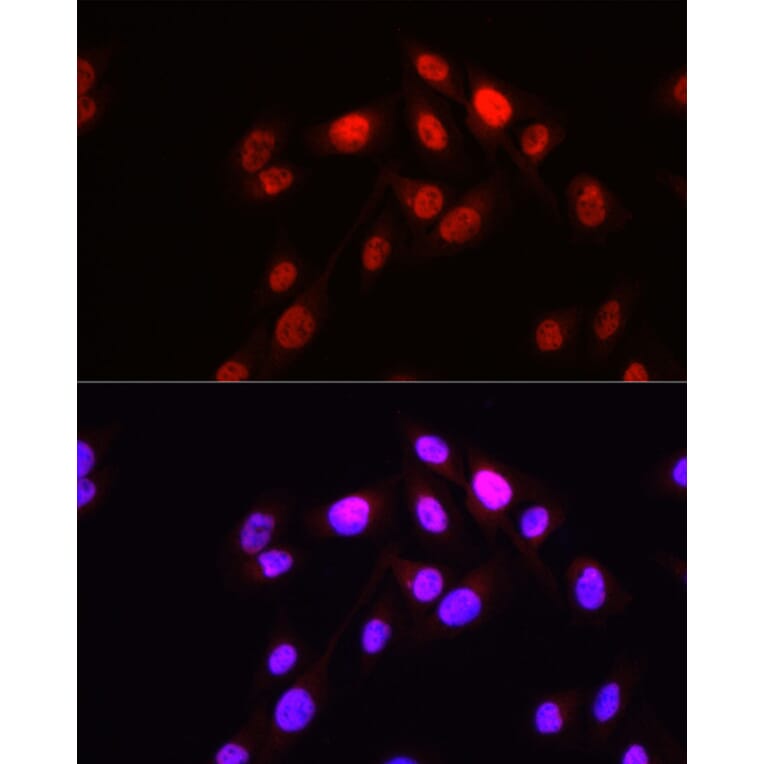 Immunofluorescence - Anti-HOPX/HOD Antibody (A88224) - Antibodies.com