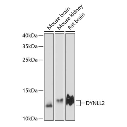 Western Blot - Anti-Dynein Antibody (A88226) - Antibodies.com