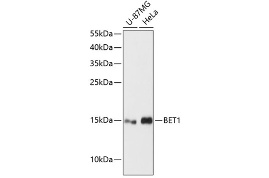 Western Blot - Anti-BET1 Antibody (A88227) - Antibodies.com