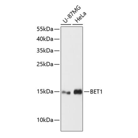 Western Blot - Anti-BET1 Antibody (A88227) - Antibodies.com