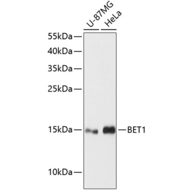Western Blot - Anti-BET1 Antibody (A88227) - Antibodies.com