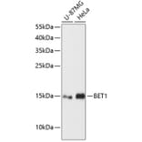 Western Blot - Anti-BET1 Antibody (A88227) - Antibodies.com