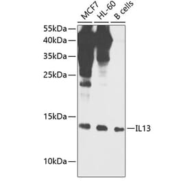 Western Blot - Anti-IL-13 Antibody (A88228) - Antibodies.com