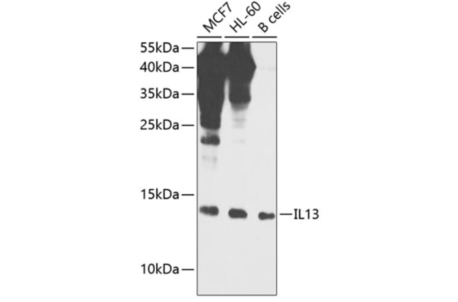 Western Blot - Anti-IL-13 Antibody (A88228) - Antibodies.com