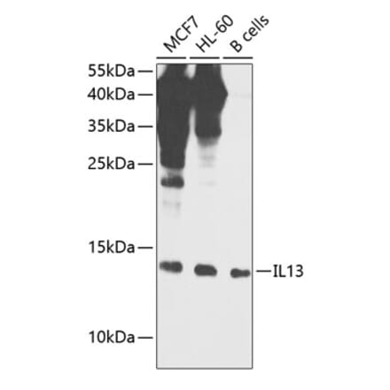 Western Blot - Anti-IL-13 Antibody (A88228) - Antibodies.com