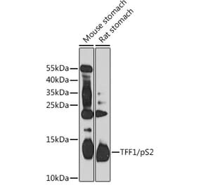 Western Blot - Anti-Estrogen Inducible Protein pS2 Antibody (A88229) - Antibodies.com