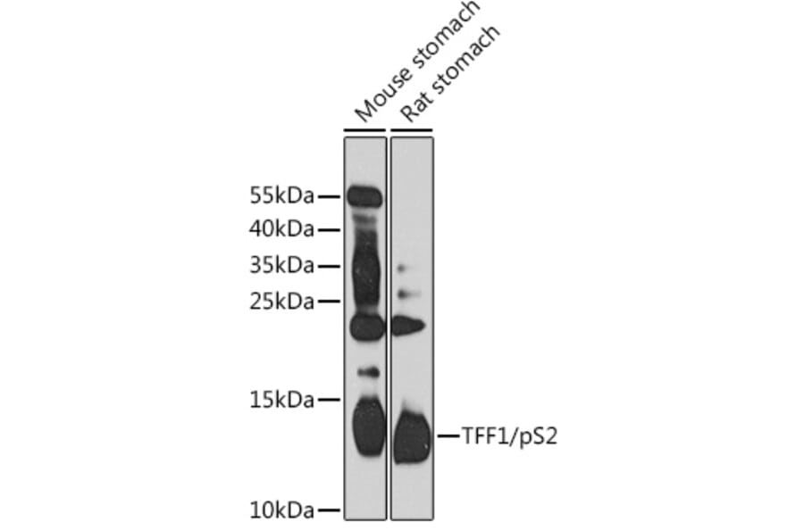Western Blot - Anti-Estrogen Inducible Protein pS2 Antibody (A88229) - Antibodies.com
