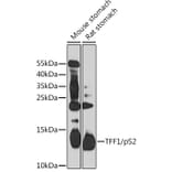 Western Blot - Anti-Estrogen Inducible Protein pS2 Antibody (A88229) - Antibodies.com