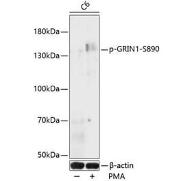 Western Blot - Anti-NMDAR1 (phospho Ser890) Antibody (A88231) - Antibodies.com