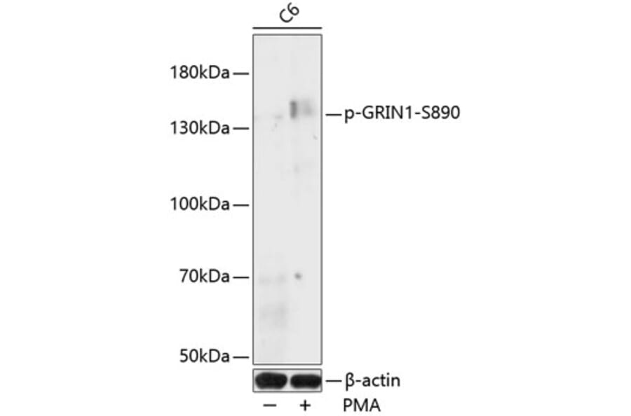 Western Blot - Anti-NMDAR1 (phospho Ser890) Antibody (A88231) - Antibodies.com