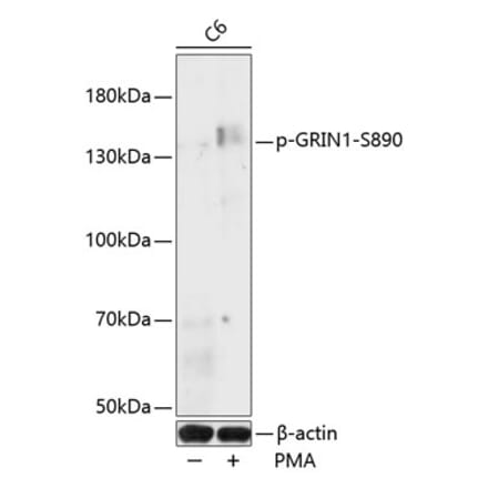 Western Blot - Anti-NMDAR1 (phospho Ser890) Antibody (A88231) - Antibodies.com