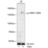 Western Blot - Anti-NMDAR1 (phospho Ser890) Antibody (A88231) - Antibodies.com