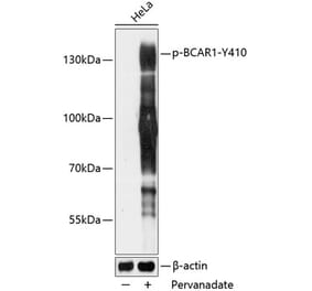 Western Blot - Anti-BCAR1 (phospho Tyr410) Antibody (A88232) - Antibodies.com